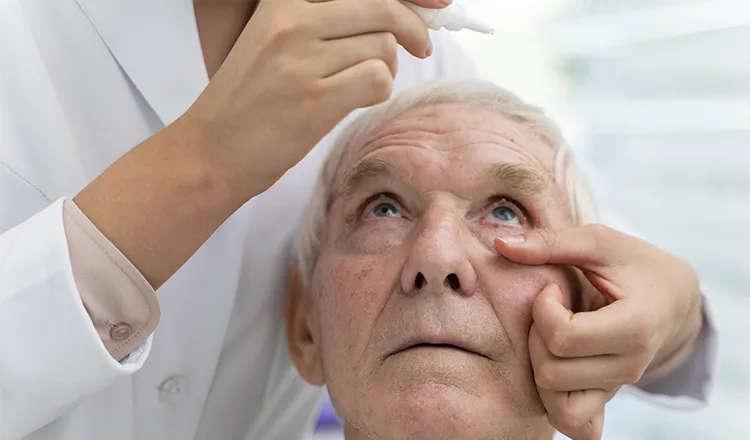 Cirurgia de catarata: o passo a passo da recuperação