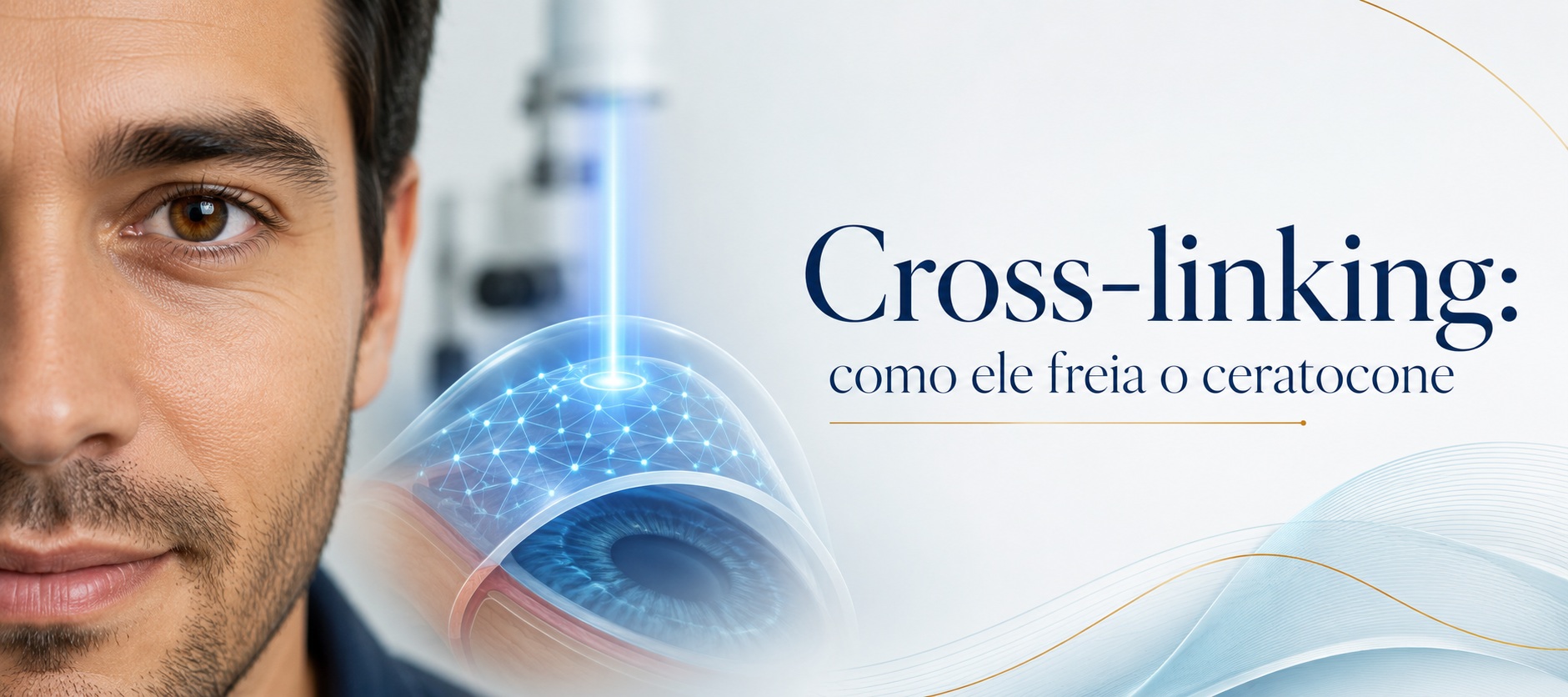 Cross-linking: como ele freia o ceratocone