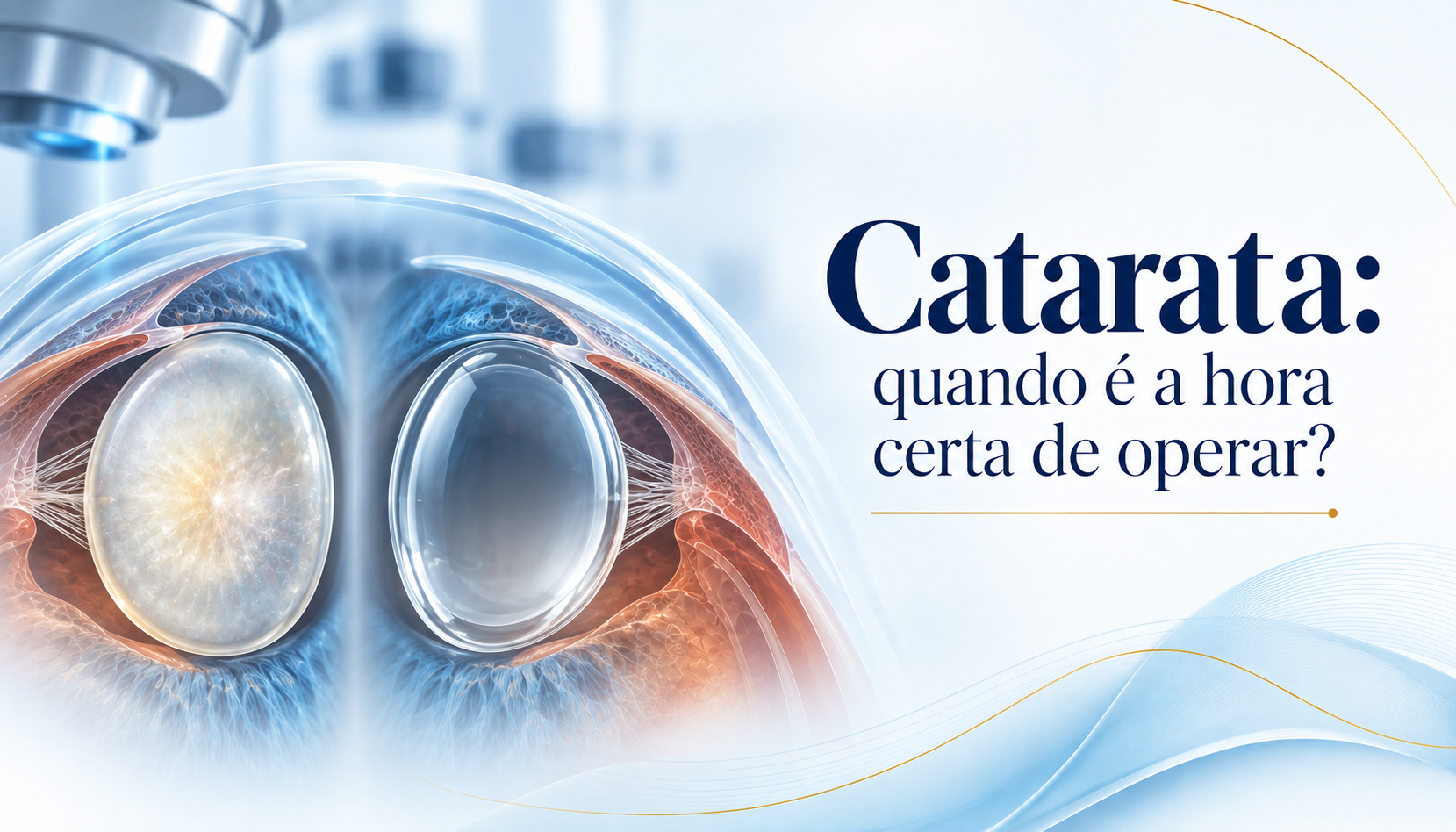 Catarata: quando é a hora certa de operar?