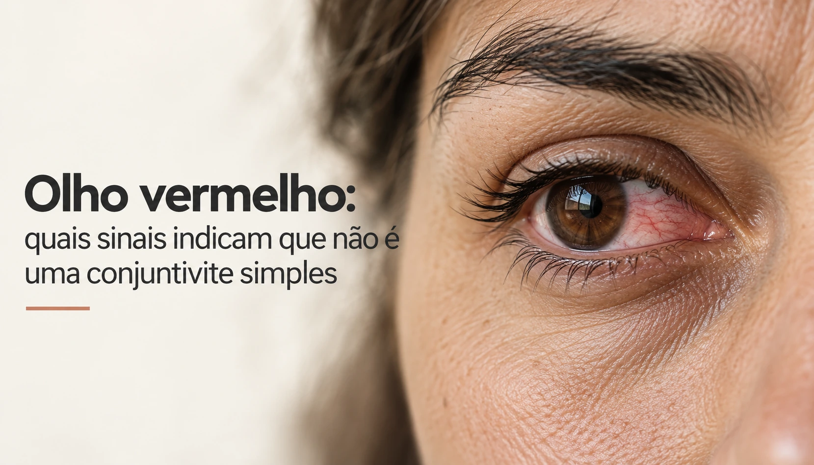 Olho vermelho: quais sinais indicam que não é uma conjuntivite simples